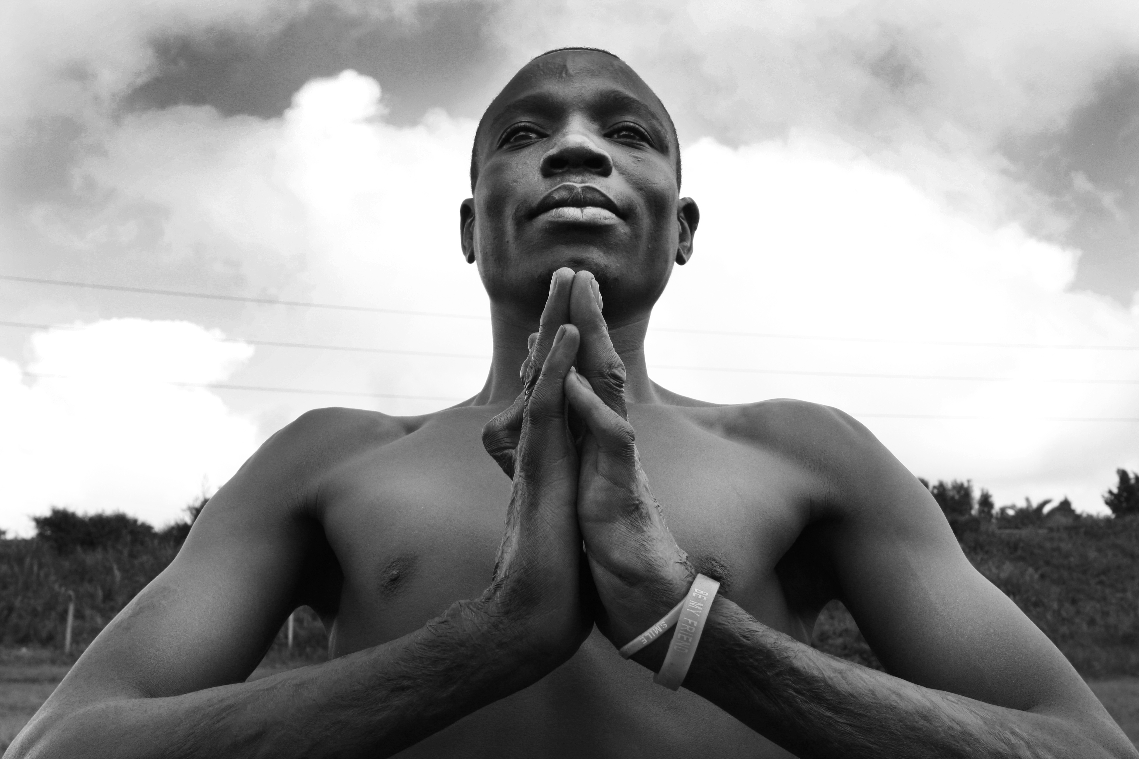 he Touching Story of an African Boy Burned in a Fire. For All of Us Who Feel Shame.